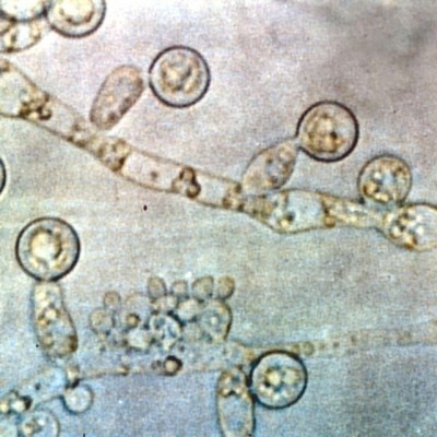 کاندیدا آلبیکانس (Candida albicans)