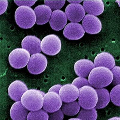 استافیلوکوکوک اورئوس (Staphylococcus aureus incl.MRSA)