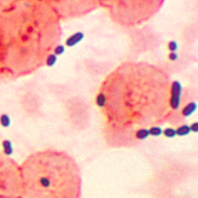 انتروکوک (Enterococcus hirae)