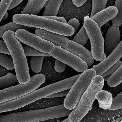 اشرشیا کلای (Escherichia coli)