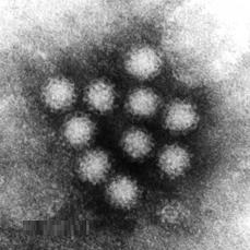 نورو ویروس (Norovirus)